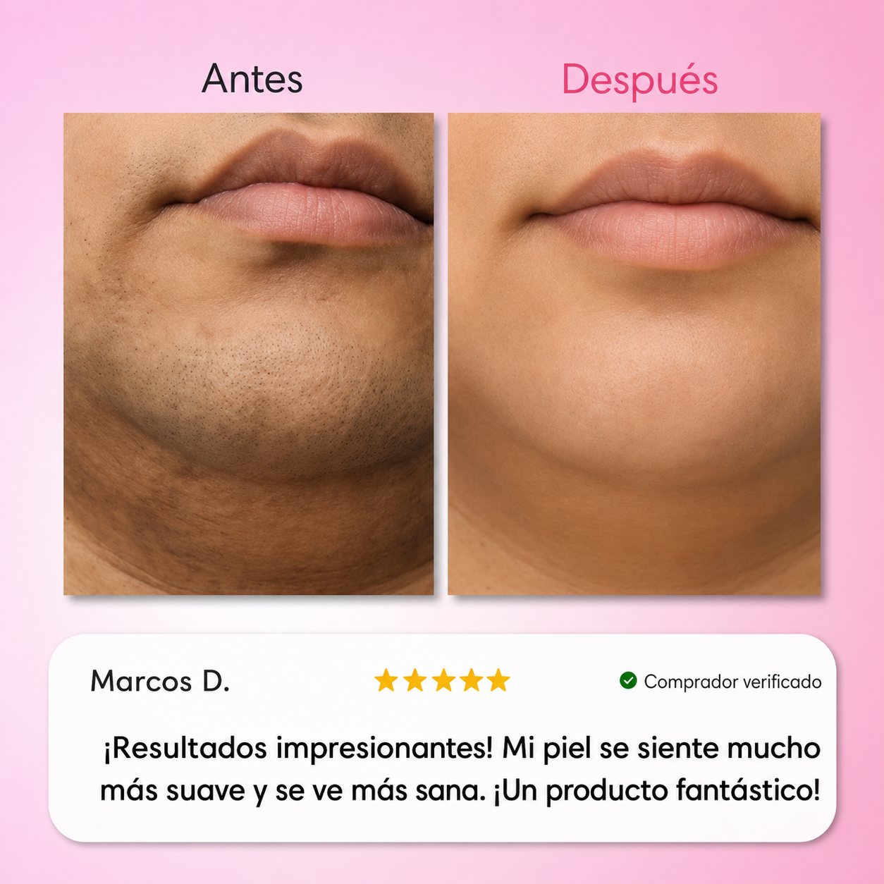 Kit Trilogy Depilación Facial