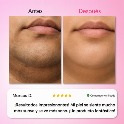 Kit Trilogy Depilación Facial