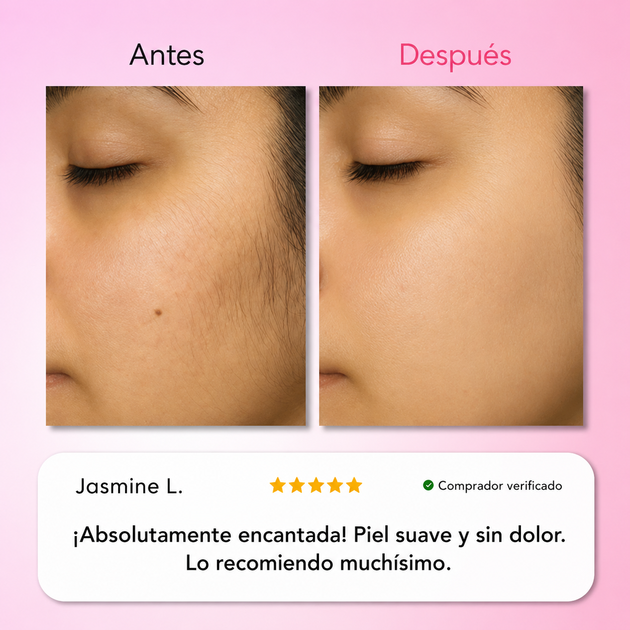 Kit Trilogy Depilación Facial