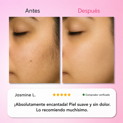 Kit Trilogy Depilación Facial